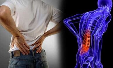 The reasons for the development of lumbar osteochondosis